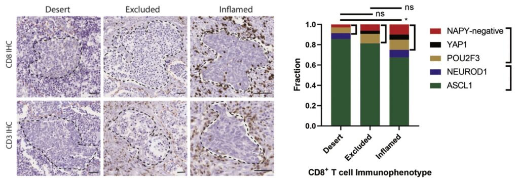 Characterization of various therapeutic markers in different molecular subtypes of SCLC (Journal of Thoracic Oncology, 2022 Jan;17(1):141-153)